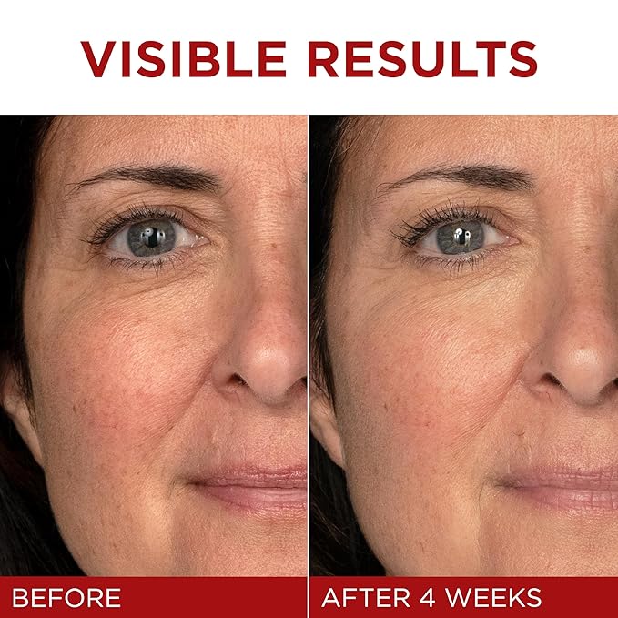 l'oreal paris revitalift triple power anti aging face moisturizer l'oreal paris revitalift triple power anti aging face moisturizer